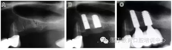 QQ圖片20150725105857.png QQ圖片20150725105857.png