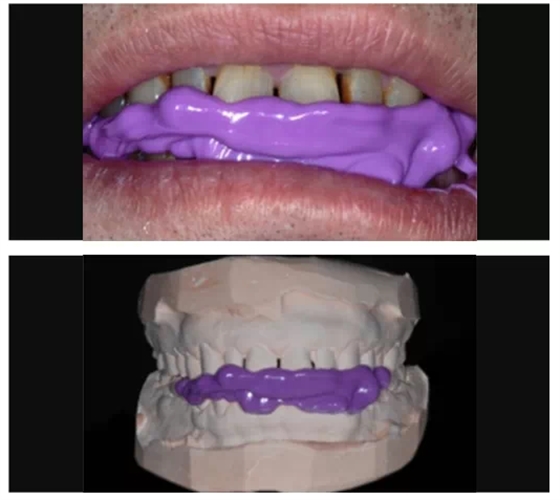 瓷貼面實(shí)戰(zhàn)流程