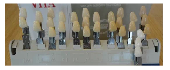 瓷貼面實(shí)戰(zhàn)流程