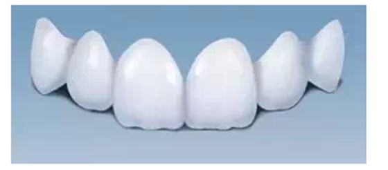 瓷貼面實(shí)戰(zhàn)流程