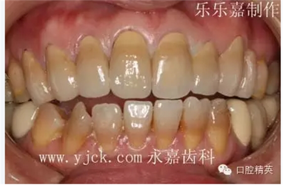 QQ圖片20150727150419.png QQ圖片20150727150419.png