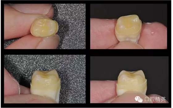 為什么你的牙齒備不好 為什么你的牙齒備不好