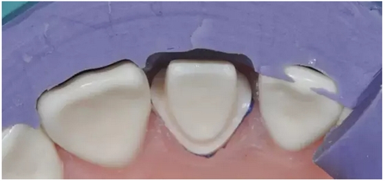 為什么你的牙齒備不好 為什么你的牙齒備不好