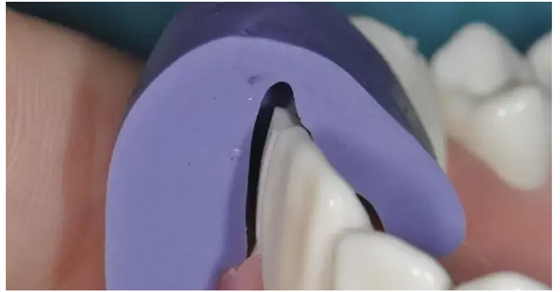 為什么你的牙齒備不好 為什么你的牙齒備不好