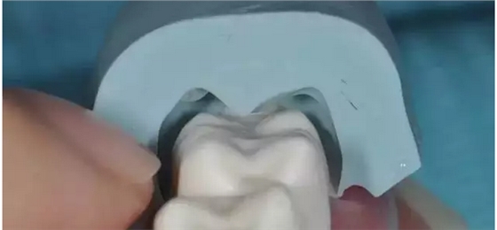 為什么你的牙齒備不好 為什么你的牙齒備不好