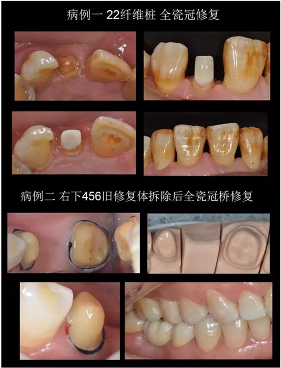 為什么你的牙齒備不好 為什么你的牙齒備不好