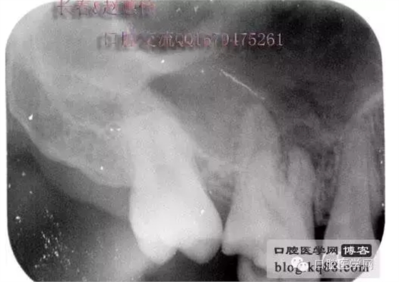 QQ圖片20150729144104.png QQ圖片20150729144104.png