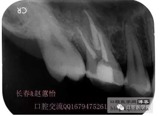 QQ圖片20150729144116.png QQ圖片20150729144116.png