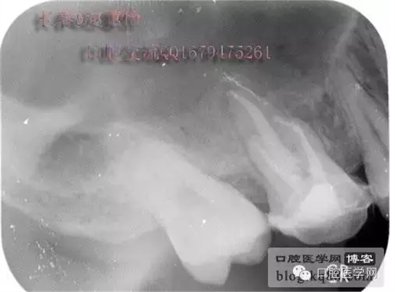 QQ圖片20150729144127.png QQ圖片20150729144127.png