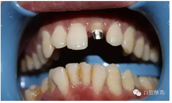 QQ圖片20150730112055.png QQ圖片20150730112055.png