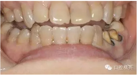 QQ圖片20150803105759.png QQ圖片20150803105759.png