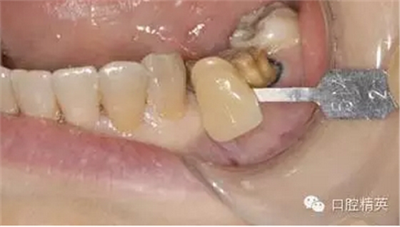 QQ圖片20150803105821.png QQ圖片20150803105821.png