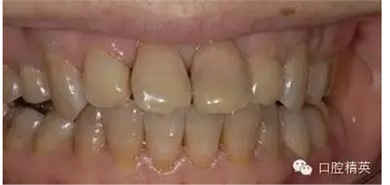 QQ圖片20150803105939.png QQ圖片20150803105939.png