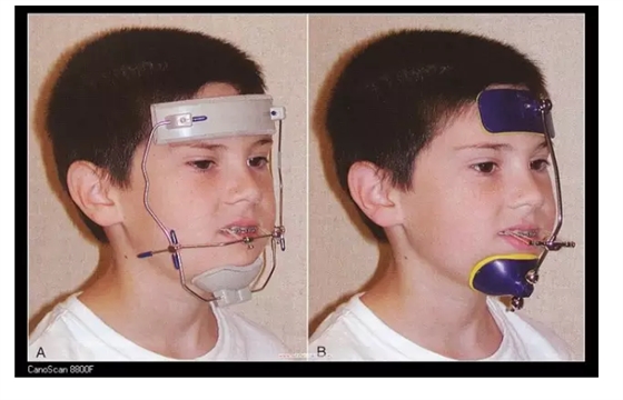 QQ圖片20150803115540.png QQ圖片20150803115540.png