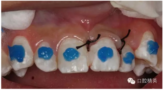 QQ圖片20150804110824.png QQ圖片20150804110824.png