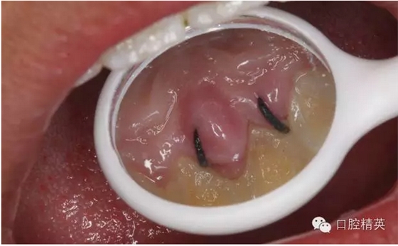 QQ圖片20150804110950.png QQ圖片20150804110950.png