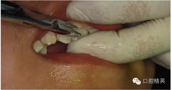 QQ圖片20150804111146.png QQ圖片20150804111146.png