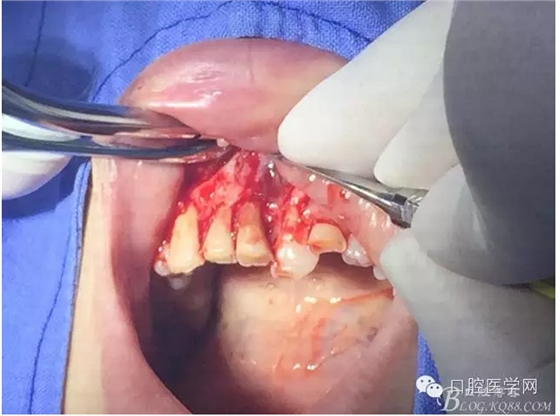 QQ圖片20150804150624.png QQ圖片20150804150624.png