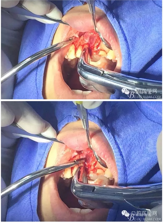 QQ圖片20150804150646.png QQ圖片20150804150646.png