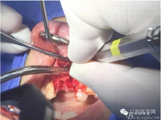 QQ圖片20150804150728.png QQ圖片20150804150728.png