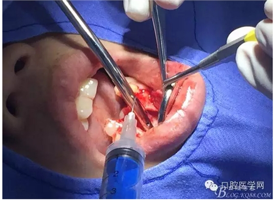 QQ圖片20150804150741.png QQ圖片20150804150741.png