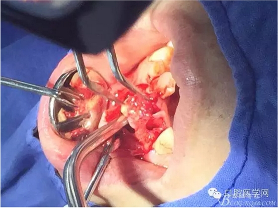 QQ圖片20150804150700.png QQ圖片20150804150700.png