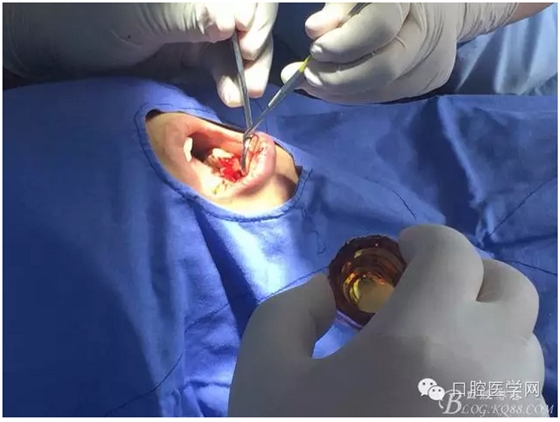 QQ圖片20150804150753.png QQ圖片20150804150753.png