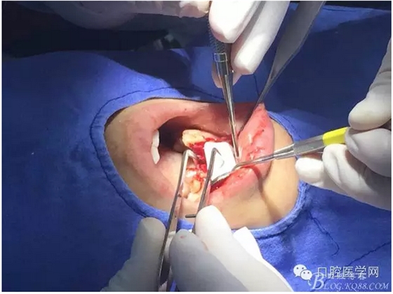 QQ圖片20150804150806.png QQ圖片20150804150806.png