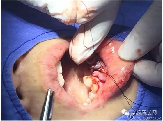 QQ圖片20150804150818.png QQ圖片20150804150818.png