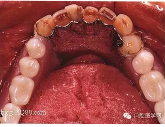 QQ圖片20150808170228.png QQ圖片20150808170228.png