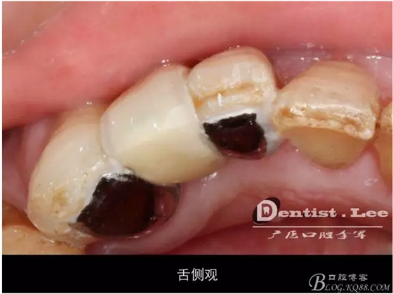 QQ圖片20150818092545.png QQ圖片20150818092545.png