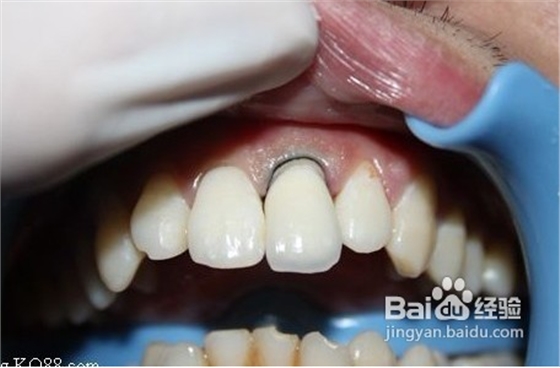 QQ圖片20150818101822.png QQ圖片20150818101822.png