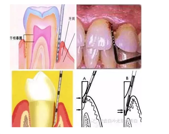 口腔檢查都有哪些流程？