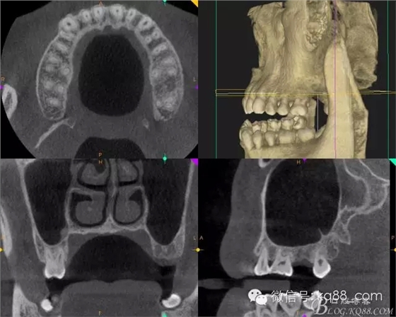 1114.webp.jpg 1114.webp.jpg