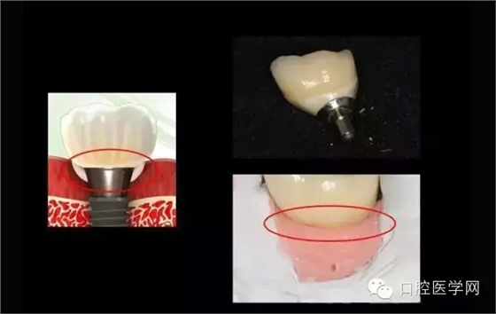 95.webp.jpg 95.webp.jpg