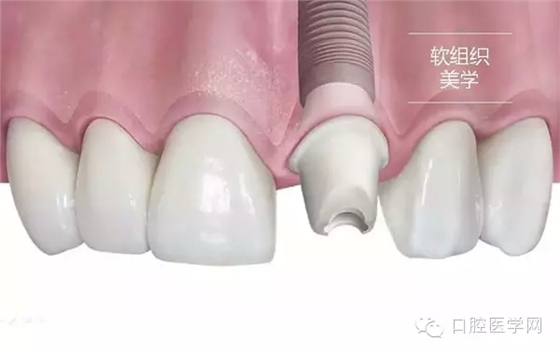 103.webp.jpg 103.webp.jpg