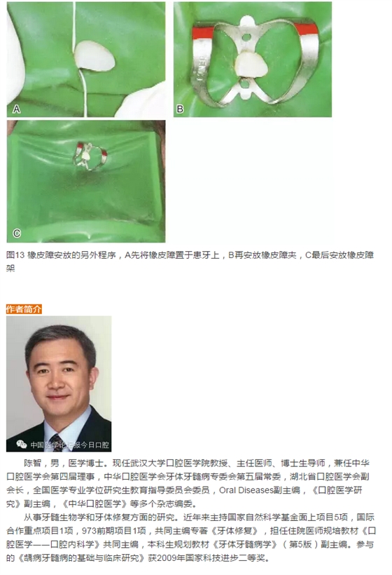 橡皮障隔離之單顆牙隔離方法——陳智教授 橡皮障隔離之單顆牙隔離方法——陳智教授