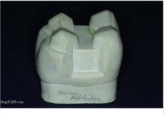 嵌體牙體預備方法 嵌體牙體預備方法