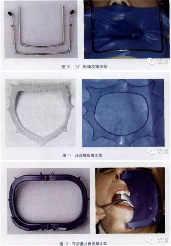 橡皮障的臨床運用大全 橡皮障的臨床運用大全