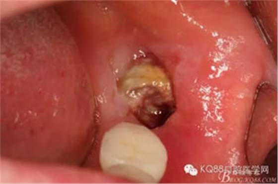 640.webp-(9).jpg 640.webp-(9).jpg