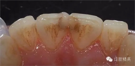 2.webp.jpg 2.webp.jpg