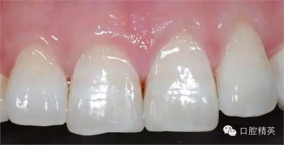 17.webp.jpg 17.webp.jpg