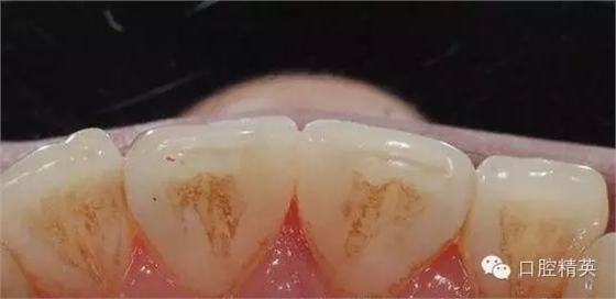 18.webp.jpg 18.webp.jpg