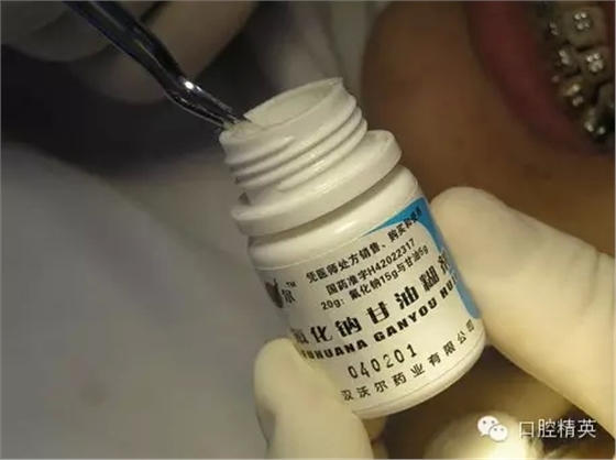 鄰面去釉臨床操作步驟組圖 鄰面去釉臨床操作步驟組圖