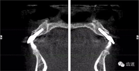 28.webp.jpg 28.webp.jpg