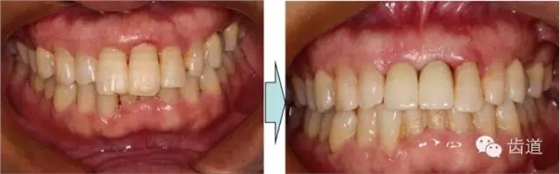 29.webp.jpg 29.webp.jpg