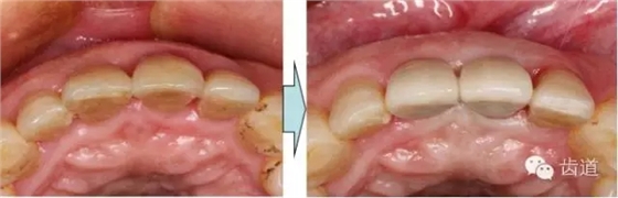 30.webp.jpg 30.webp.jpg