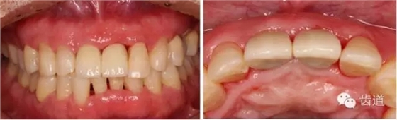 31.webp.jpg 31.webp.jpg