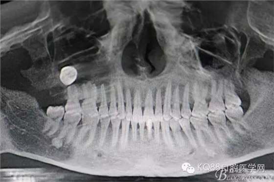 12.webp.jpg 12.webp.jpg