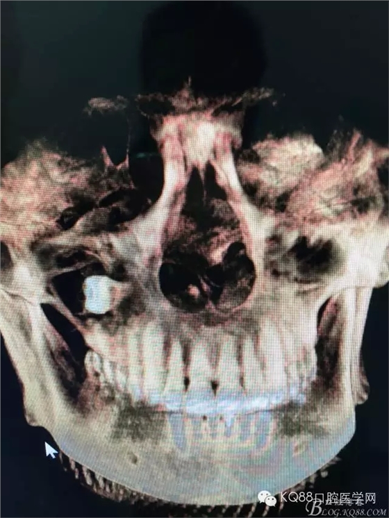 14.webp.jpg 14.webp.jpg